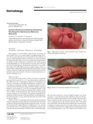 Systemic Phototoxicity following Intralesional Rose Bengal for ...