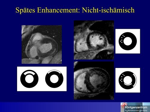 Differentialdiagnose des spÃ¤ten Enhancements