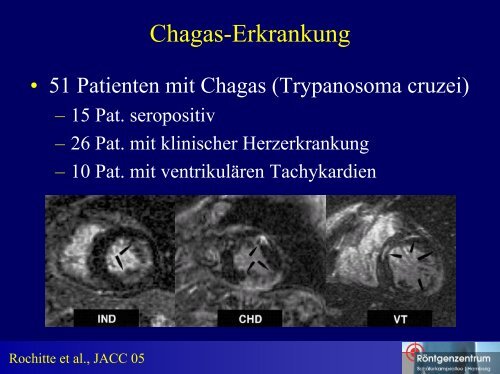 Differentialdiagnose des spÃ¤ten Enhancements