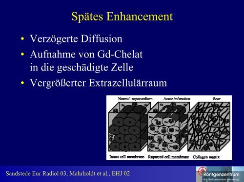 Differentialdiagnose des spÃ¤ten Enhancements