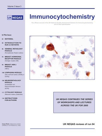 Northumbria University - UK NEQAS for Immunocytochemistry ...