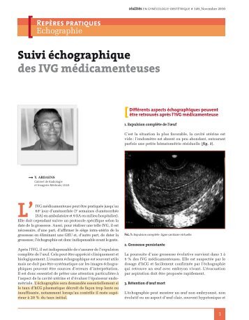 Suivi Ã©chographique des IVG mÃ©dicamenteuses