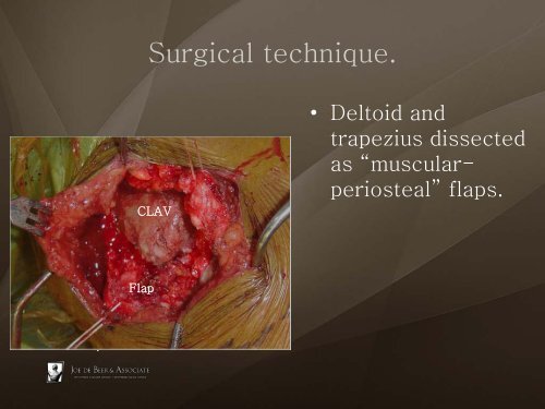 (Arthroscopic) Rotator Cuff Repair - ShoulderDoc.co.uk