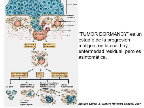 metastÃ¡sica