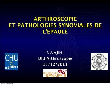 ARTHROSCOPIE ET PATHOLOGIES SYNOVIALES DE L'EPAULE