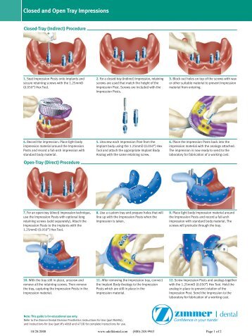 Zimmer Spline Impression - Udell dental laboratory