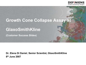 Growth Cone Collapse Assay at GlaxoSmithKline - Definiens