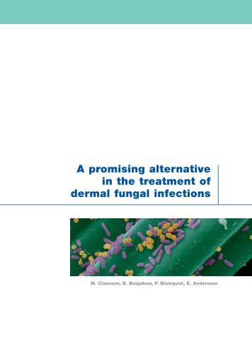 A promising alternative in the treatment of dermal fungal ... - Cutimed