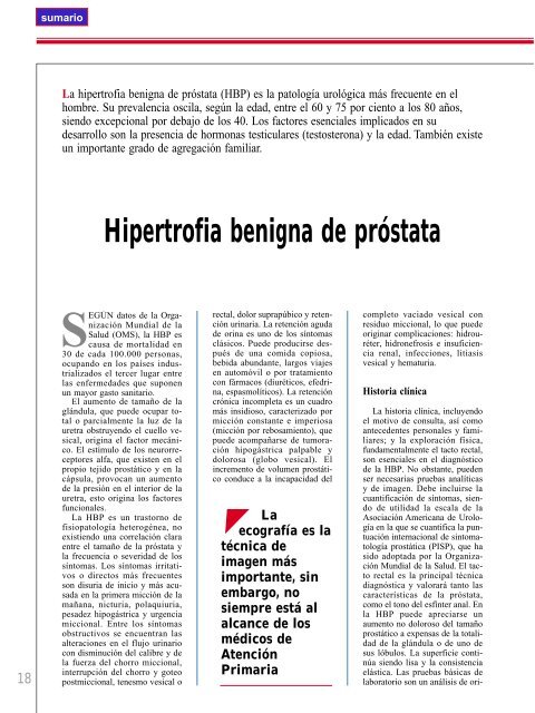 Hipertrofia benigna de prÃ³stata - El MÃ©dico Interactivo