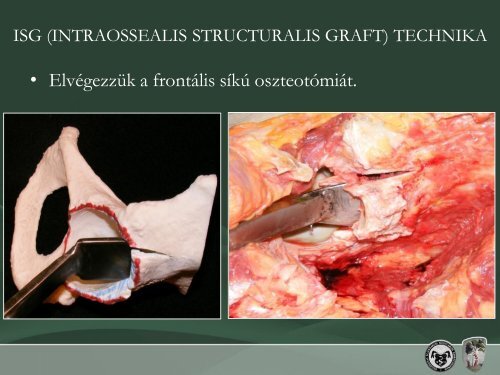 intraossealis structuralis graft technika - Debreceni Egyetem