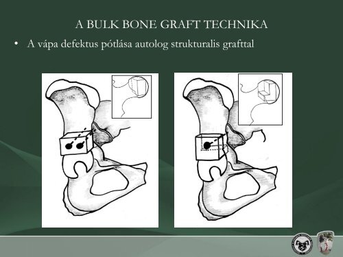 intraossealis structuralis graft technika - Debreceni Egyetem