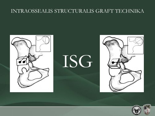 intraossealis structuralis graft technika - Debreceni Egyetem