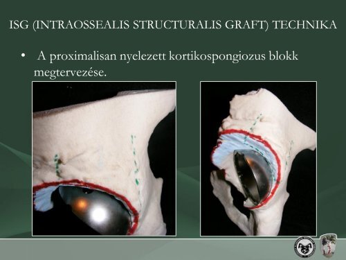 intraossealis structuralis graft technika - Debreceni Egyetem