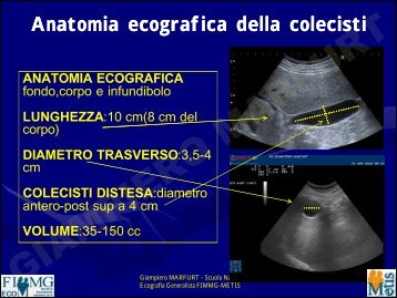 anatomia ecografica delle vie biliari - dr. giampiero ... - Sito web MIEI