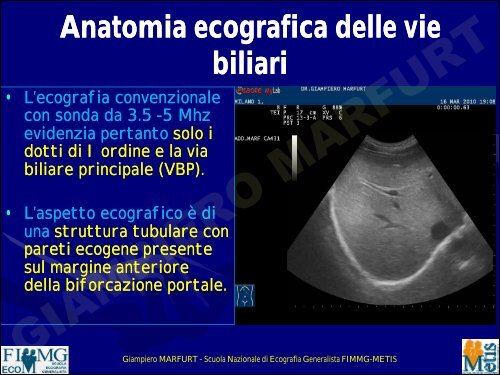 anatomia ecografica delle vie biliari - dr. giampiero ... - Sito web MIEI