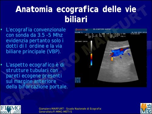 anatomia ecografica delle vie biliari - dr. giampiero ... - Sito web MIEI