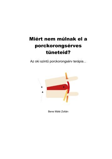 Miért nem múlnak el a porckorongsérves tüneteid?