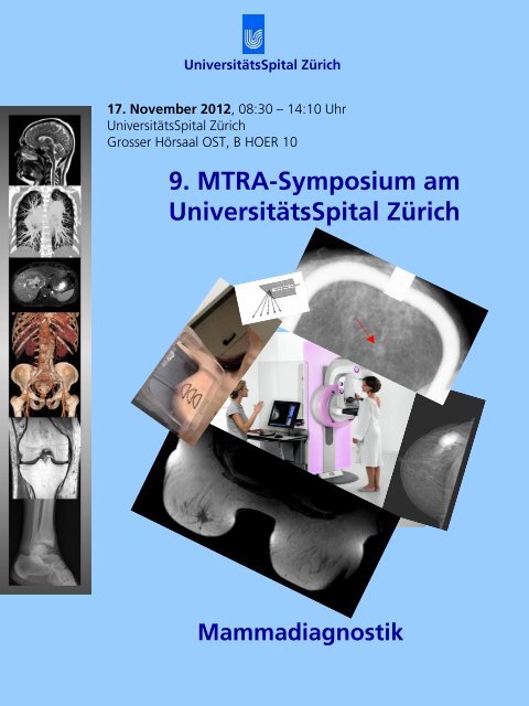 9. MTRA-Symposium am UniversitÃ¤tsSpital ZÃ¼rich - Radiologie ...