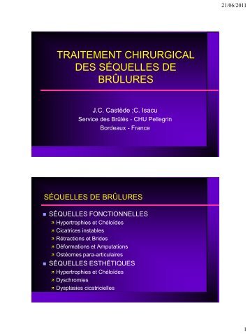 traitement chirurgical des sÃ©quelles de brÃ»lures - e-plastic.fr