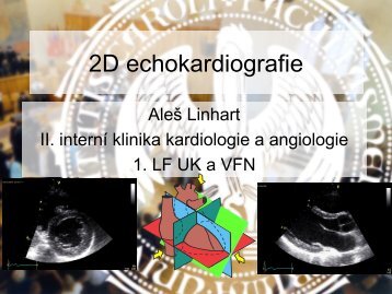 2D echokardiografie