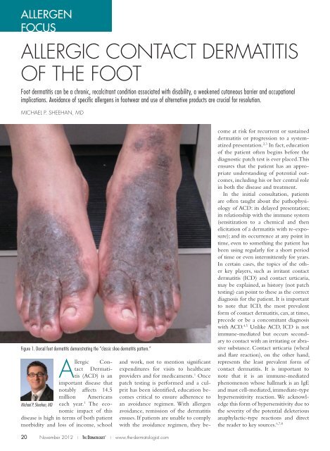 Allergic coNtAct DermAtitis of the foot - The Dermatologist