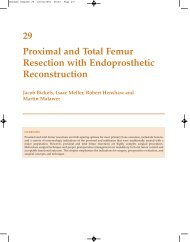 29 Proximal and Total Femur Resection with ... - Sarcoma.org