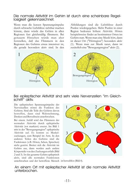 Informationstafeln Epilepsie - Krankenhaus Mara