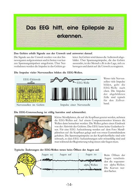 Informationstafeln Epilepsie - Krankenhaus Mara