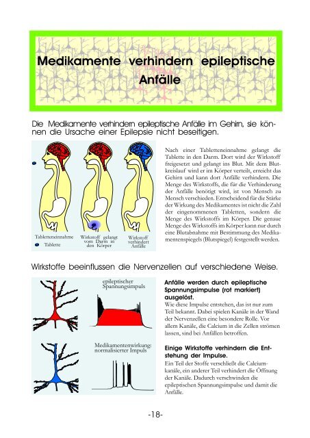 Informationstafeln Epilepsie - Krankenhaus Mara