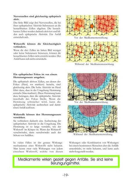 Informationstafeln Epilepsie - Krankenhaus Mara