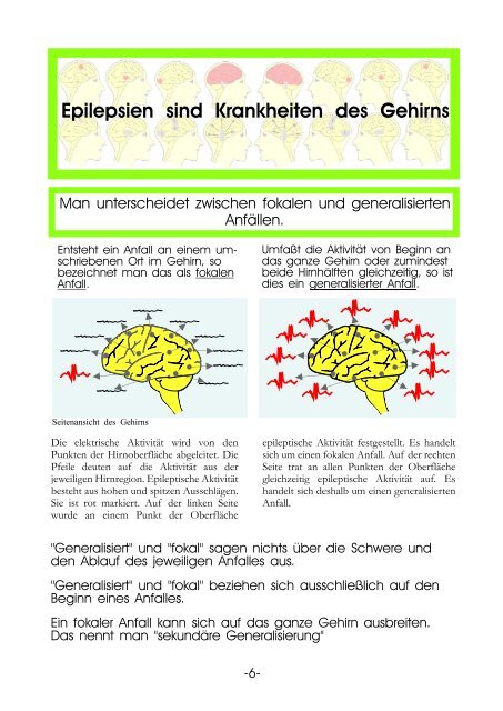 Informationstafeln Epilepsie - Krankenhaus Mara