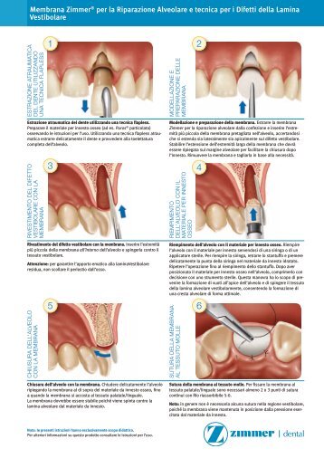 Membrana ZimmerÃ‚Â® per la Riparazione Alveolare e ... - Zimmer Dental