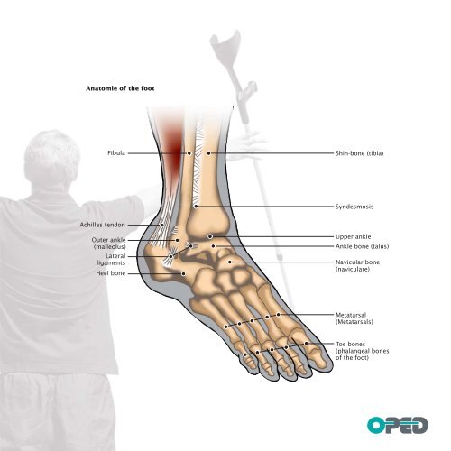 Follow-up treatment booklet foor - VACOped