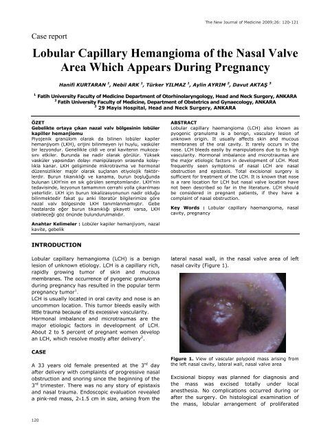 Lobular Capillary Hemangioma of the Nasal Valve Area Which ...