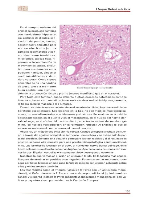 Congreso Nacional de la Carne - Eurocarne