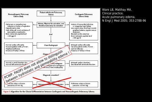 Pulmonary edema