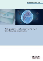 Slide preparation of cerebrospinal fluid for cytological examination