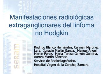 Manifestaciones radiológicas del linfoma no Hodgkin
