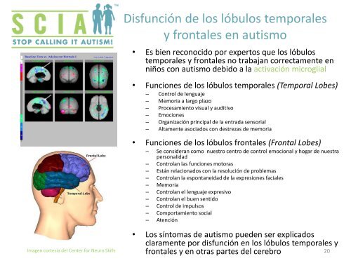 La Activación Microglial En El Autismo - Curando el Autismo