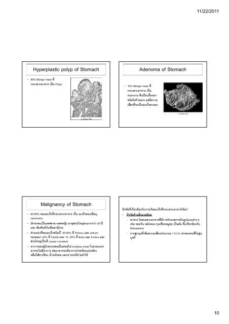 ATRESIA AND FISTULAS