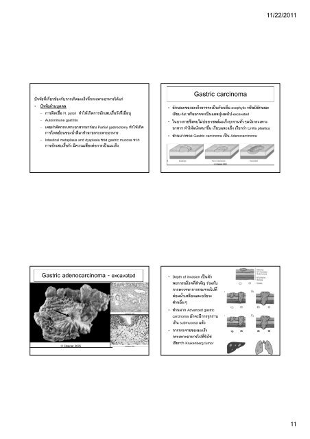 ATRESIA AND FISTULAS