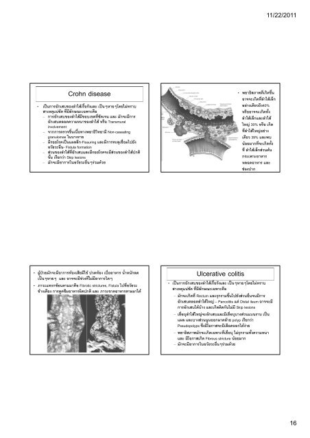 ATRESIA AND FISTULAS