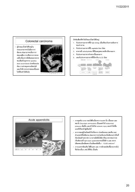 ATRESIA AND FISTULAS