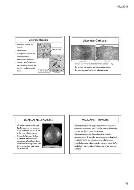 ATRESIA AND FISTULAS