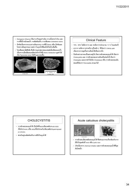 ATRESIA AND FISTULAS