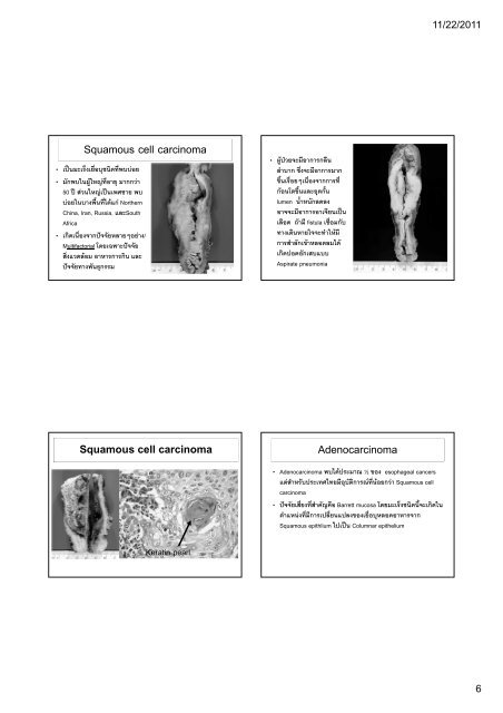 ATRESIA AND FISTULAS