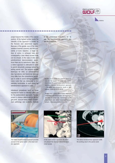 VERTEBRIS Lumbar-Thoracic - Richard Wolf