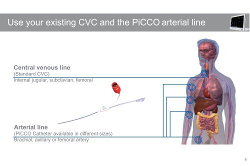 PiCCO2 Nurse Booklet - PULSION Medical Systems SE