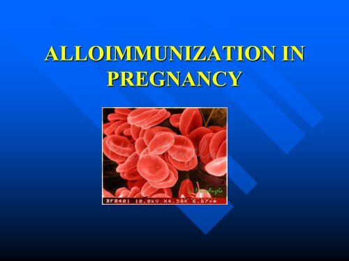 ALLOIMMUNIZATION IN PREGNANCY