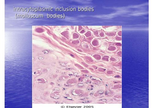 VIRAL INFECTION53_1slide.pdf